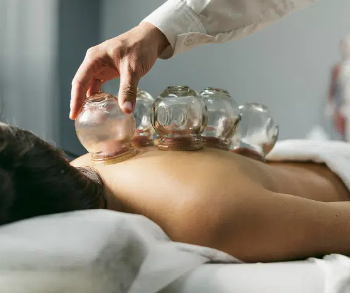 Cupping / Blood Letting Cupping