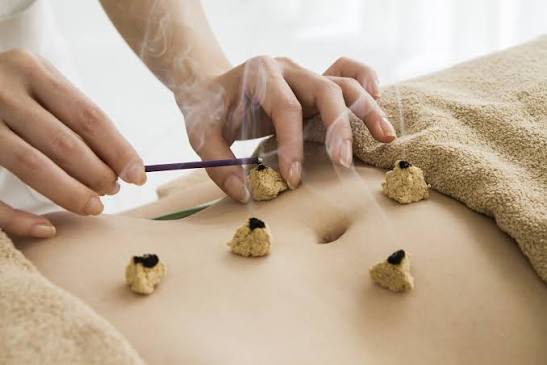 Moxibustion Therapy